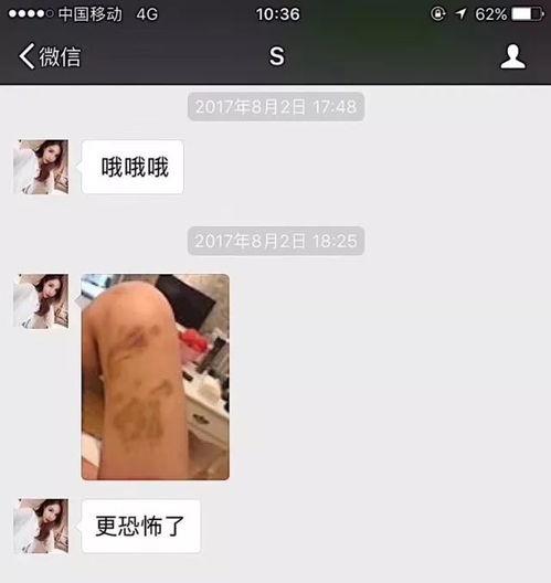 都有哪些网红被家暴了呢,盘点遭遇家庭暴力的网红